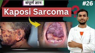 quotUnderstanding Kaposi Sarcoma Symptoms Causes and Treatmentquot cancer viralinfection Mltwallah [upl. by Goodwin]