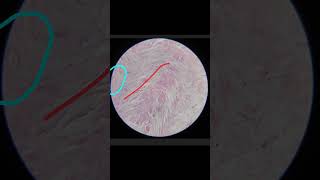 White Fibrocartilage Histology Anatomy 1st year MBBS [upl. by Novikoff]