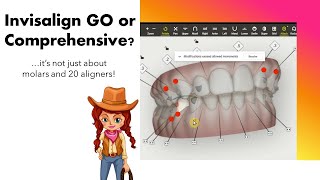 Invisalign ClinCheck Choosing between iGo vs Comprehensive  IPR tips [upl. by Orme532]