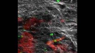 Cytotoxic T Cells Migrating Through Pancreatic Tumors [upl. by Ardnasal]