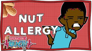 What Happens When Someone With an Allergy Eats Nuts  Operation Ouch  Nugget [upl. by Nertie]