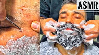 Asmr Beard Cut • Acne clearing and relaxation session • MASSAGE [upl. by Hardan]