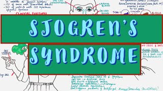 Sjogrens Syndrome  Causes Clinical features Diagnosis amp Treatment [upl. by Syla944]