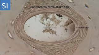 Schistosoma hematobium egg in urine [upl. by Moreta]