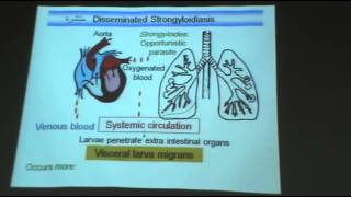 DrAzza  Parasitology  Nematodes 4  quotstrongyloides stercoralis  capillaria philippinensisquot [upl. by Ojimmas751]