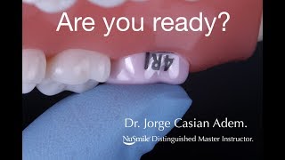 NuSmile Permanent Molar Crown Handson Workshop by Jorge Casián [upl. by Intosh]