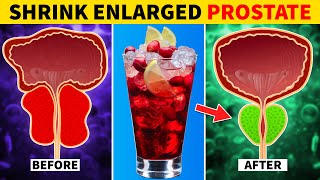 8 Juices to Shrink an Enlarged Prostate [upl. by Angelina371]