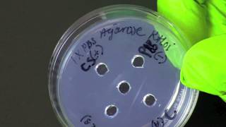 How To Perform An Ouchterlony Assay Double Immunodiffusion Assay [upl. by Ahsitil985]