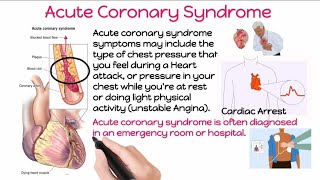 What is Acute Coronary Syndrome and Heart Attack  Symptoms and CAUSES of Acute Coronary Syndrome [upl. by Arimahs]