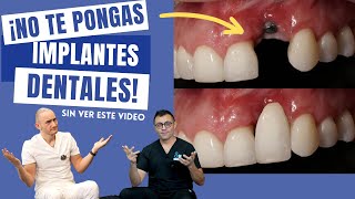 ¡No te pongas un Implante Dental sin ver este video [upl. by Lled]