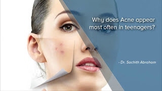 Why Does Acne Appear Often In Teenagers  Best Skin Doctors In Bangalore  Manipal Hospitals [upl. by Eintirb]