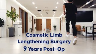 PostOp 9 years after leg lengthening surgery [upl. by Dorette]