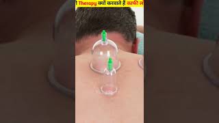 What is cupping therapy facts [upl. by Inaluahek]