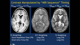 MRI Basics Part 1 [upl. by Enaffit]