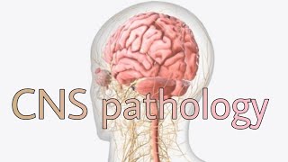 CNS pathology 1st lecture [upl. by Nissy]