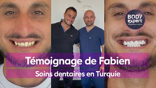 CLINIQUE DENTAIRE EN TURQUIE  🦷 Témoignage Fabien  20 couronnes Emax  gummy smile  BODYEXPERT [upl. by Jeuz865]