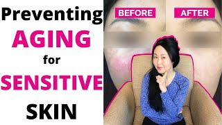 Preventing Aging for Sensitive or Rosacea Skin [upl. by Tnilk558]