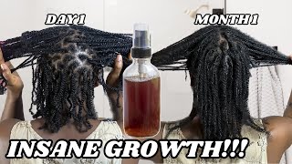 YOUR HAIR WON’T STOP GROWING WITH THIS  INCREASE YOUR HAIR GROWTH WITH THIS TREATMENT [upl. by Eidnalem635]