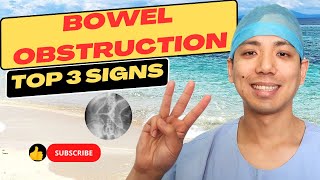 Do I have a small bowel obstruction Top 3 signs for small bowel obstruction and how to treat it [upl. by Oivlis]