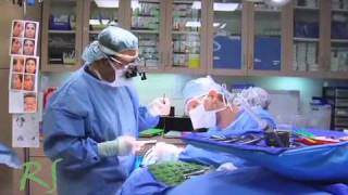 Revision Rhinoplasty with rib grafting [upl. by Akirdnas]