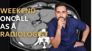 RADIOLOGIST ON CALL vlog 12 hours in the hospital [upl. by Annora]