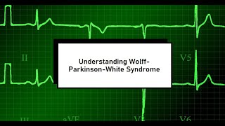 Understanding WolffParkinsonWhite Syndrome ECG [upl. by Leiand]