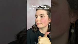 Rosacea Flareup Makeup tutorial  sensitive skin [upl. by Angrist120]