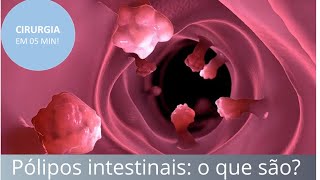 Pólipos intestinais o que são como diagnosticar e tratar  Fernando Eyer [upl. by Assillim]