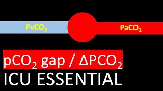 Why YOU Should Compare Venous amp Arterial CO2 [upl. by Ueihtam]