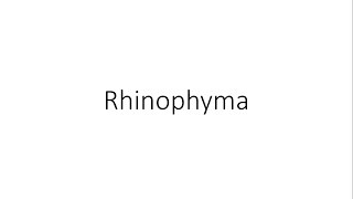 Rhinophyma  ENT [upl. by Elroy]