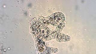 Amoeba from a pond in Oregon feeding and division [upl. by Guenevere]