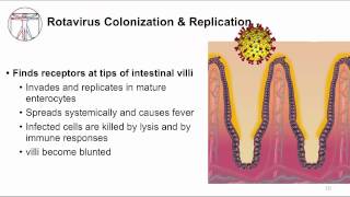 Acute GI Watery diarrhea and viruses [upl. by Treble896]