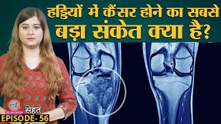 Bone Cancer से बचने का उपाय Doctors से जान लीजिए  Sehat Ep 56 [upl. by Bailar]