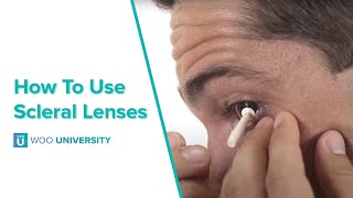 How To Insert and Remove Scleral Lenses [upl. by Vashtia]