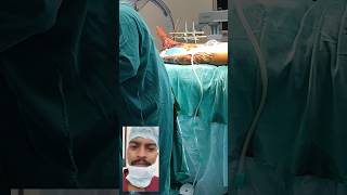 ilizarov type surgery ortho operation with vac dressing [upl. by Nikki]