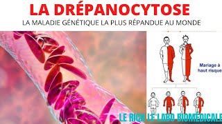 La drépanocytose  physiopathologie facteurs déclenchant les crises comment éviter la maladie [upl. by Nyltiak]