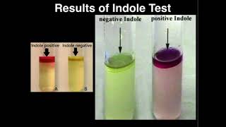 Microbiology Indole Test Tryptophanase [upl. by Frankel759]