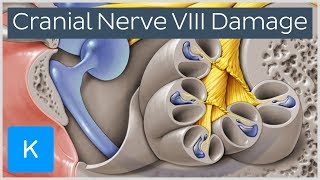 What happens when the vestibulocochlear nerve is damaged  Human Anatomy  Kenhub [upl. by Otsedom428]