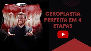 Ceroplastia Perfeita  Magno Sanches [upl. by Amadis785]