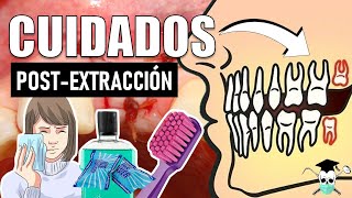 CUIDADOS después de una EXTRACCIÓN DENTAL 7 Tips [upl. by Stouffer]