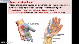 Overview of UL 14  Deep Fascia of Palm of the Hand  Dr Ahmed Farid [upl. by Assirralc]