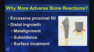 The Science behind humeral stem length in shoulder arthroplasty [upl. by Anawd959]