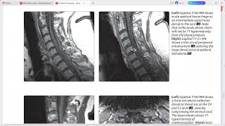 SPINE IMAGING DIAGNOSTIC IMAGING SERIES [upl. by Stark]