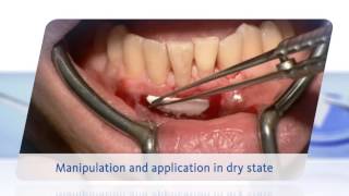 Geistlich Mucograft® Handling Video [upl. by Forelli422]