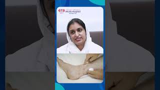 What to Know About Homeopathic Remedies for Eczema  Listen to Dr Nadia Homeopathy Practitioner [upl. by Hortense]