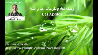 وصفة لعلاج تقرحات الفم و اللثة Remède contre les Aphtes [upl. by Ky]