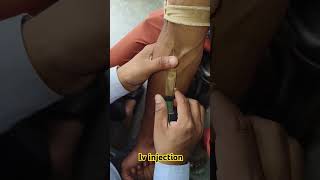 Iv injection shorts trending medicalprocedure drxsachin12 [upl. by Suhail528]