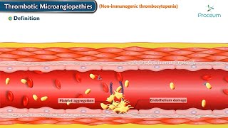 Thrombotic Microangiopathies  TM Thrombotic Thrombocytopenic Purpura  TTP   Hematology [upl. by Brag]