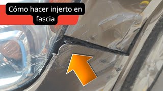 como hacer un injerto en fascia [upl. by Ahsielat102]