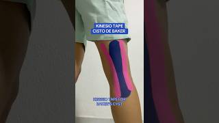 COMO COLOCAR KINESIO TAPE PARA CISTO DE BAKER ✅ [upl. by Euqinomad]